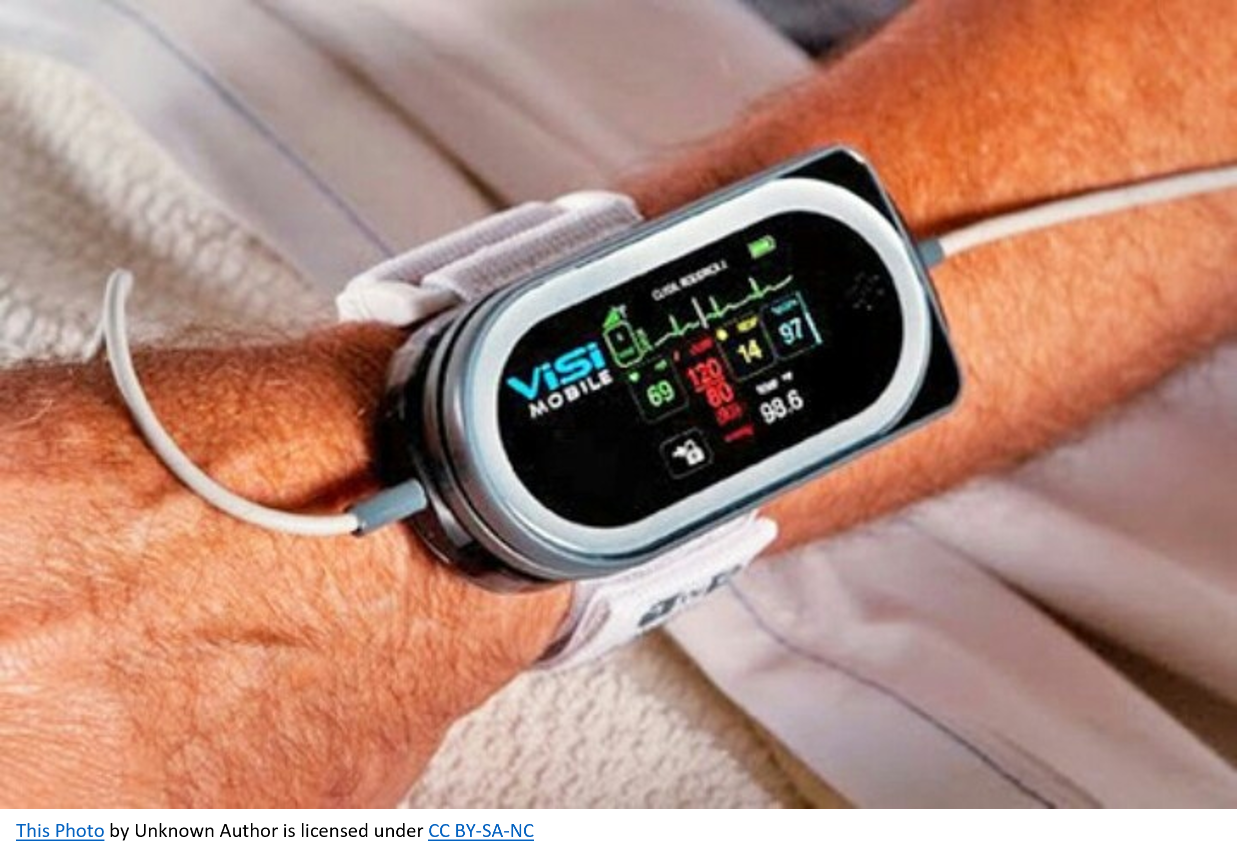 wearable health technology